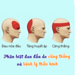 Phân biệt đau đầu do căng thẳng và bệnh lý thần kinh